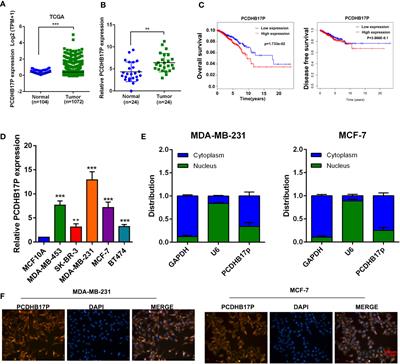 PCDHB17P/miR-145-3p/MELK/NF-κB Feedback Loop Promotes Metastasis and Angiogenesis of Breast Cancer